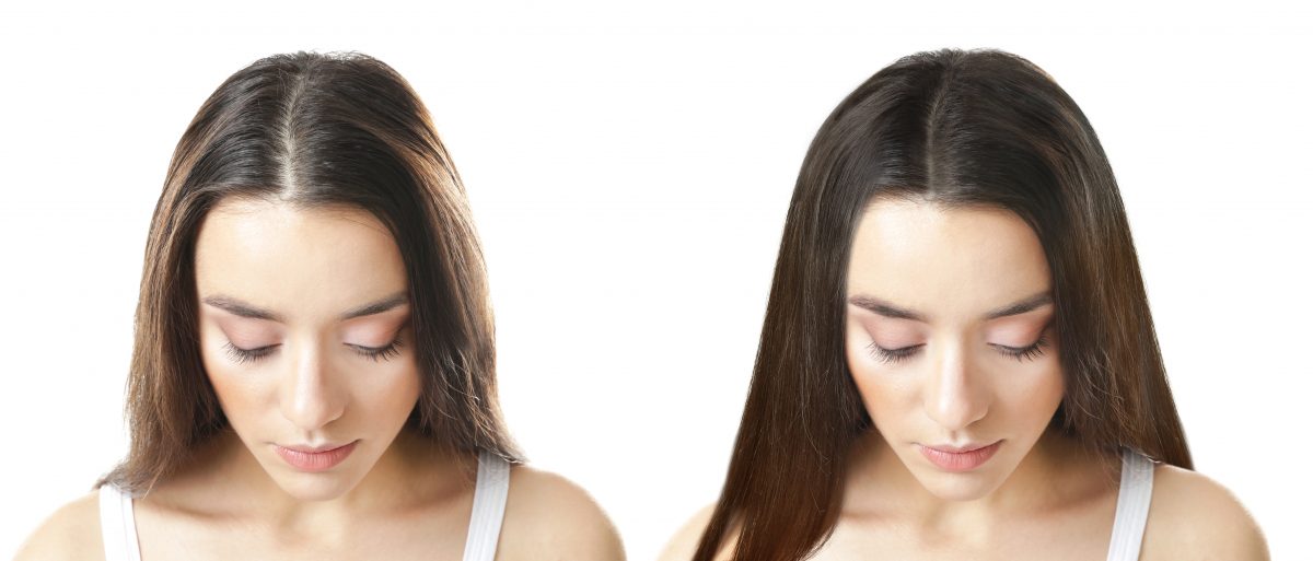 woman before after hair serum