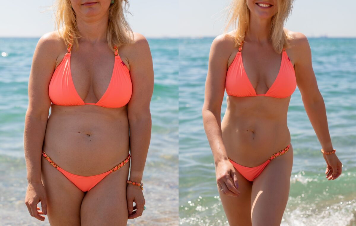 A woman in a bikini on the beach showing a before and after of her weightloss with semaglutide