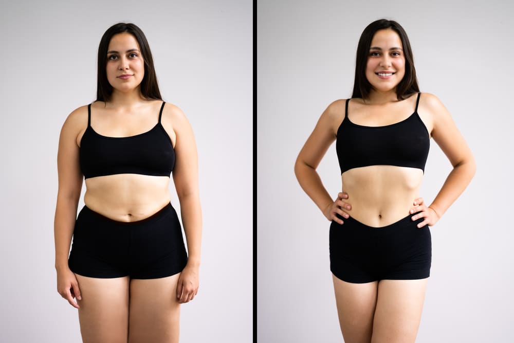 A woman before and after achieving weight loss with Tirzepatide at WildBerryMD in Tucson